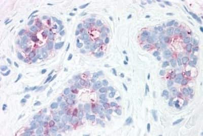 Immunohistochemistry-Paraffin: Synaptogyrin 2 Antibody [NBP3-14490] - Immunohistochemistry of formalin-fixed, paraffin-embedded human breast after heat-induced antigen retrieval.